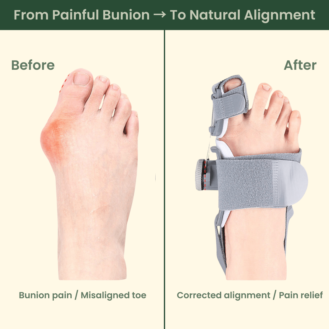EvoStep Sleep&Step™ Correction Kit - EvoStep
