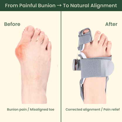 EvoStep Sleep&Step™ Correction Kit - EvoStep