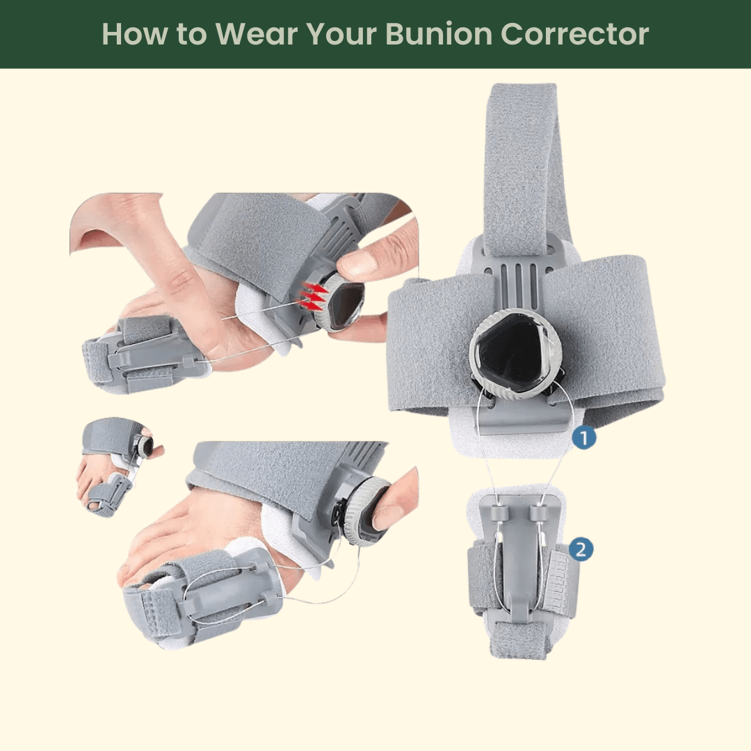 EvoStep Sleep&Step™ Correction Kit - EvoStep