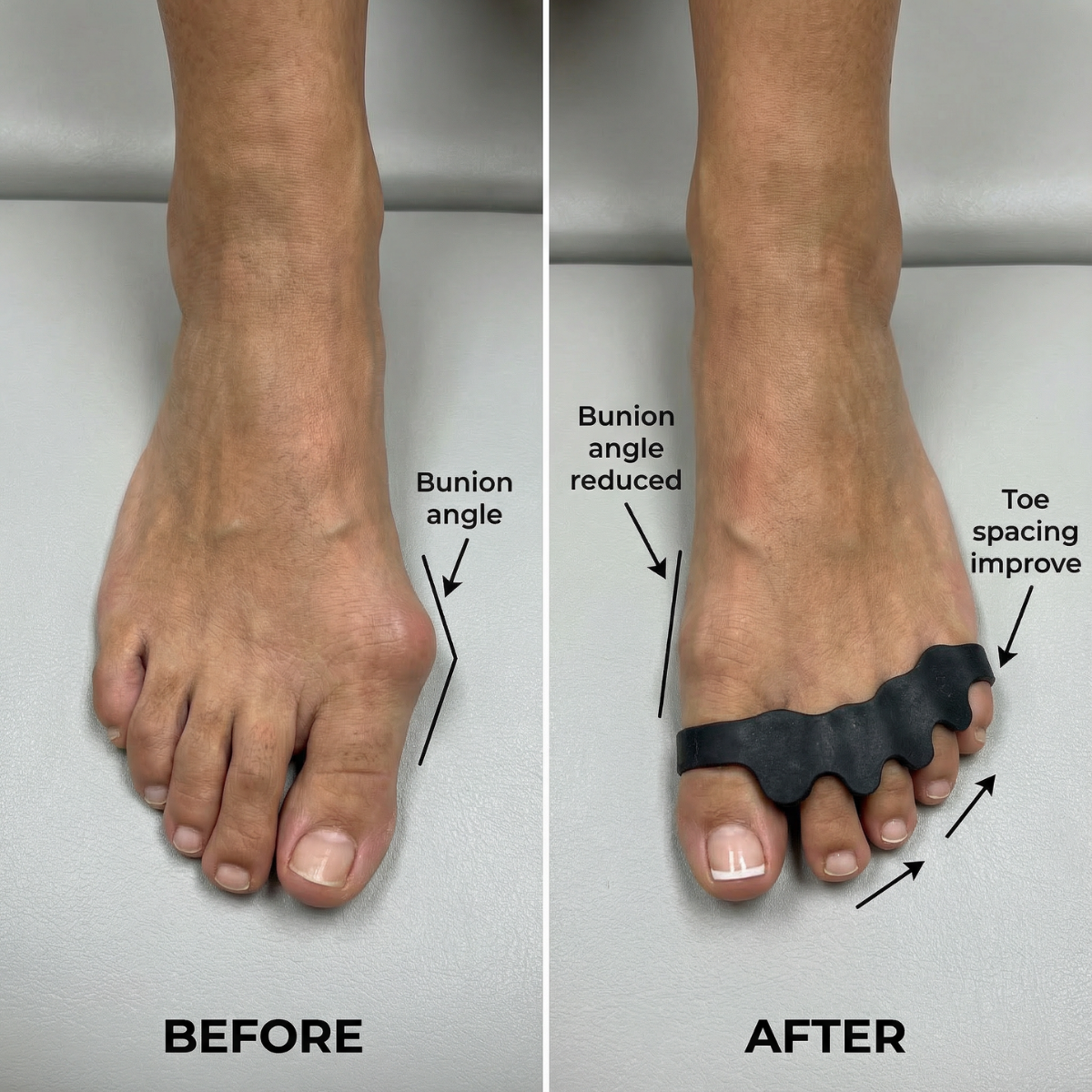 EvoStep BioAlign™ Medical-Grade Silicone