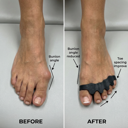 EvoStep BioAlign™ Medical-Grade Silicone